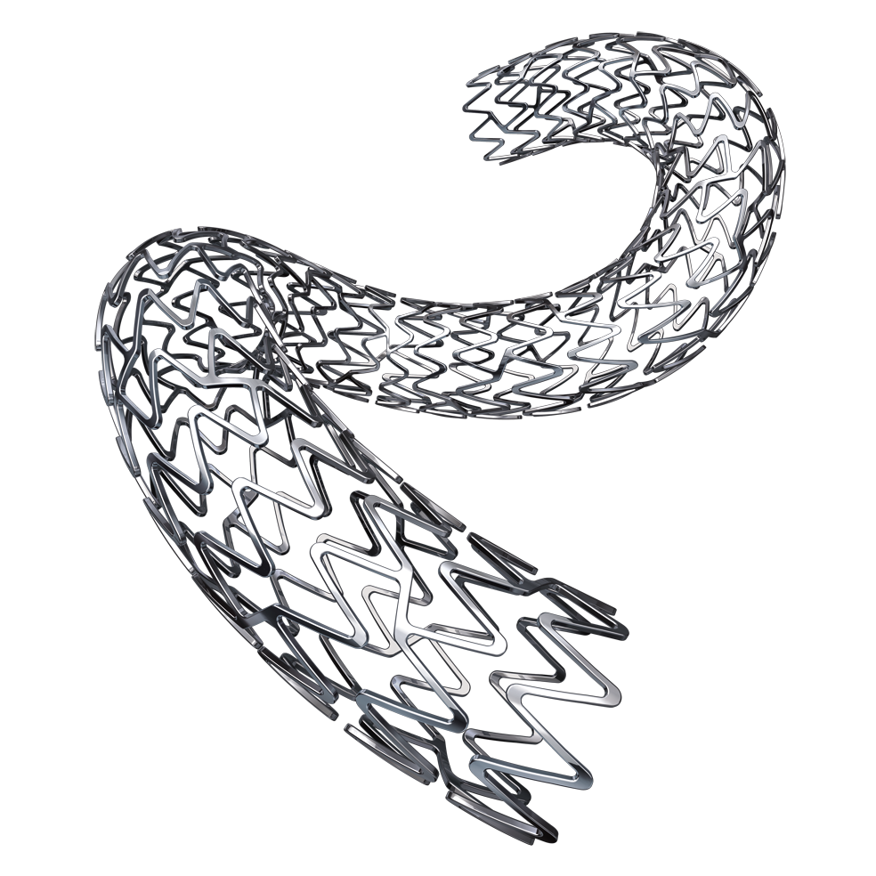 foto-stent